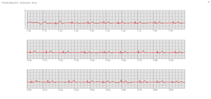 Záznam meření EKG z aplikace Garmin Connect